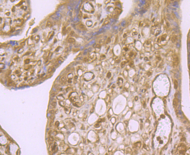 Immunohistochemical analysis of paraffin-embedded human placenta tissue using anti-RBX1 antibody. Counter stained with hematoxylin.