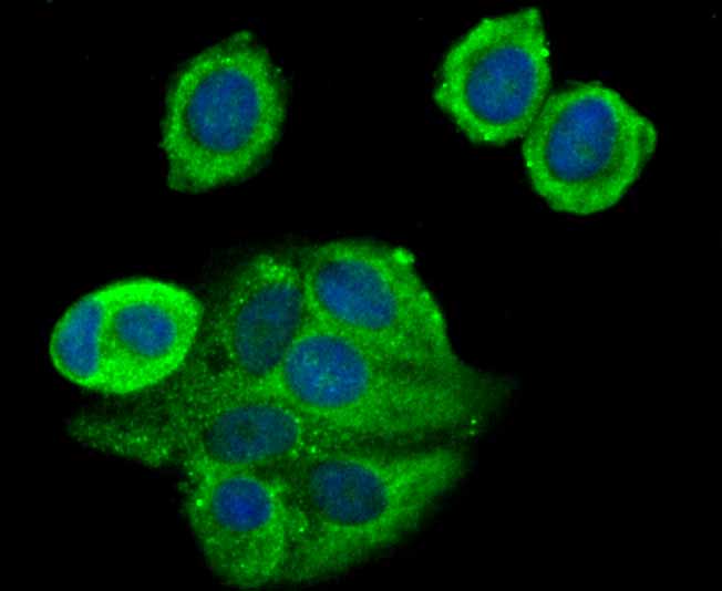 ICC staining TAK1 in MCF-7 cells (green). The nuclear counter stain is DAPI (blue). Cells were fixed in paraformaldehyde, permeabilised with 0.25% Triton X100/PBS.