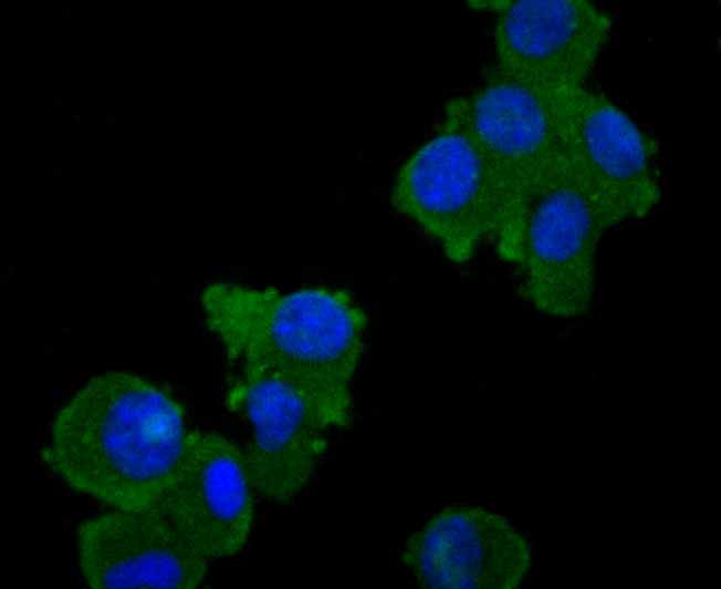 ICC staining TAK1 in N2A cells (green). The nuclear counter stain is DAPI (blue). Cells were fixed in paraformaldehyde, permeabilised with 0.25% Triton X100/PBS.