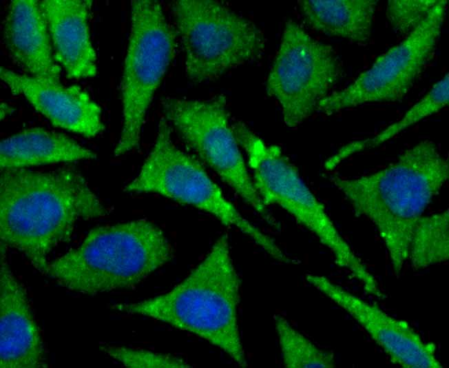 ICC staining TAK1 in SH-SY-5Y cells (green). The nuclear counter stain is DAPI (blue). Cells were fixed in paraformaldehyde, permeabilised with 0.25% Triton X100/PBS.