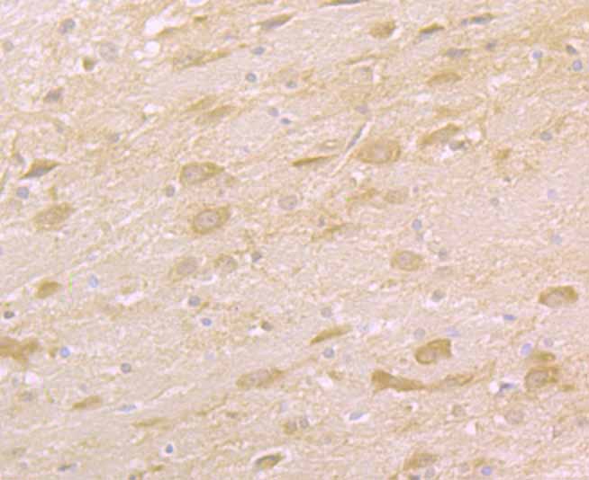 Immunohistochemical analysis of paraffin-embedded rat brain tissue using anti-TAK1 antibody. Counter stained with hematoxylin.