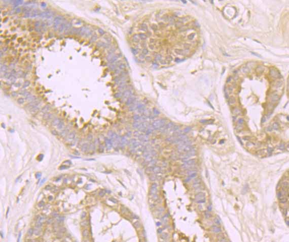 Immunohistochemical analysis of paraffin-embedded human breast tissue using anti-TAK1 antibody. Counter stained with hematoxylin.