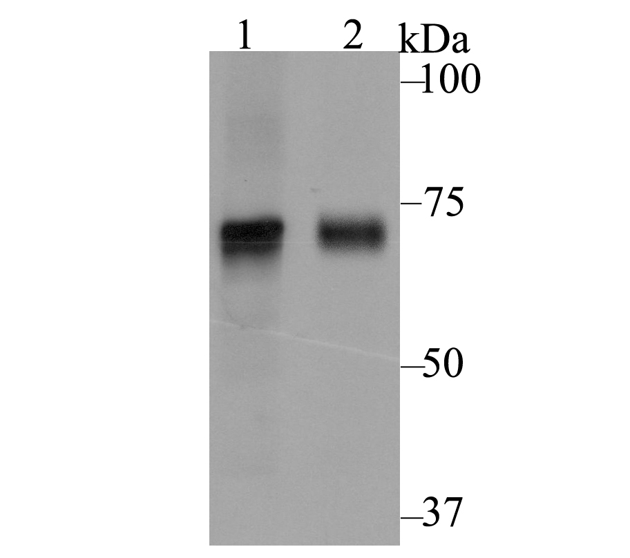 Western blot analysis of Kv4.3 on different lysates using anti-Kv4.3 antibody at 1/1,000 dilution.<br />
Positive control:<br />
Lane 1: MCF-7 cell lysate  <br />
Lane 2: Mouse marrow tissue lysate