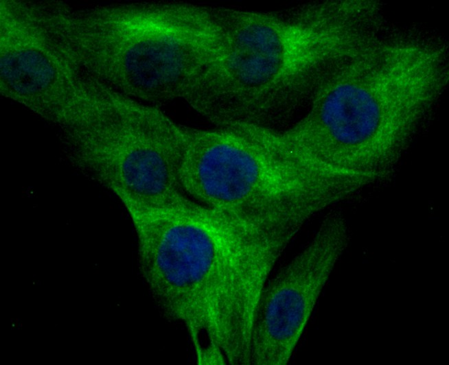 ICC staining Kv4.3 in MG-63 cells (green). The nuclear counter stain is DAPI (blue). Cells were fixed in paraformaldehyde, permeabilised with 0.25% Triton X100/PBS.