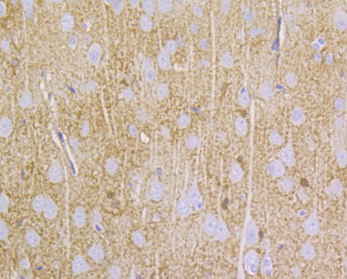 Immunohistochemical analysis of paraffin-embedded rat brain tissue using anti-NDRG2 antibody. Counter stained with hematoxylin.