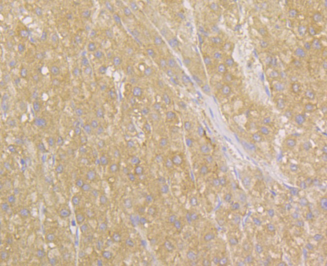 Immunohistochemical analysis of paraffin-embedded human liver tissue using anti-NDRG2 antibody. Counter stained with hematoxylin.