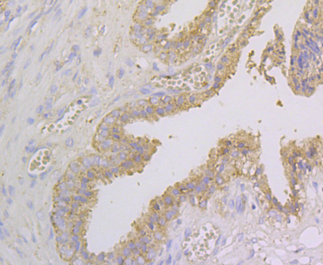 Immunohistochemical analysis of paraffin-embedded human prostate tissue using anti-NDRG2 antibody. Counter stained with hematoxylin.