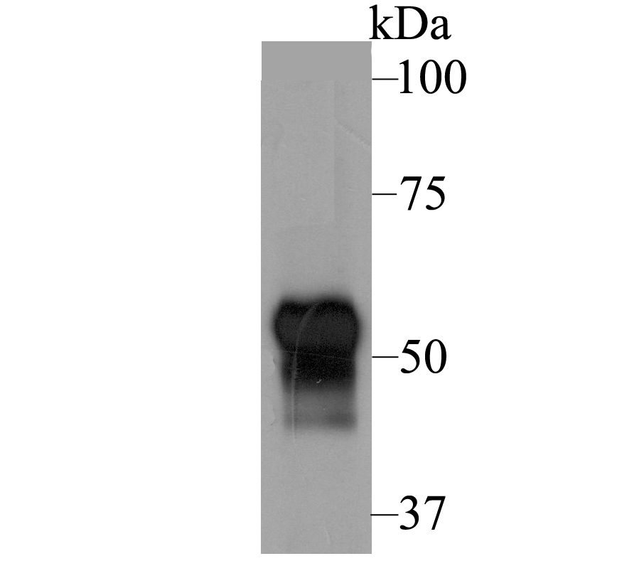 Western blot analysis of Fibulin 5 on human skin tissue lysate using anti-Fibulin 5 antibody at 1/1,000 dilution.