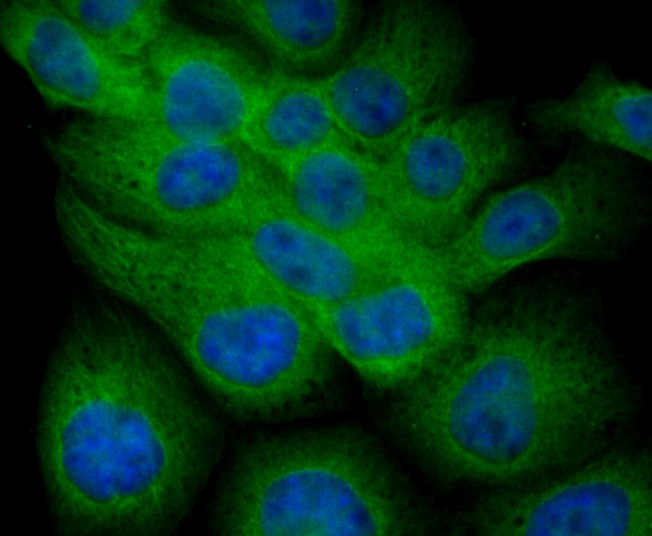 ICC staining Fibulin 5 in JAR cells (green). The nuclear counter stain is DAPI (blue). Cells were fixed in paraformaldehyde, permeabilised with 0.25% Triton X100/PBS.