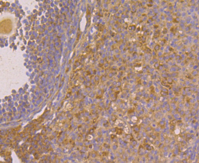 Immunohistochemical analysis of paraffin-embedded mouse ovary tissue using anti-Fibulin 5 antibody. Counter stained with hematoxylin.