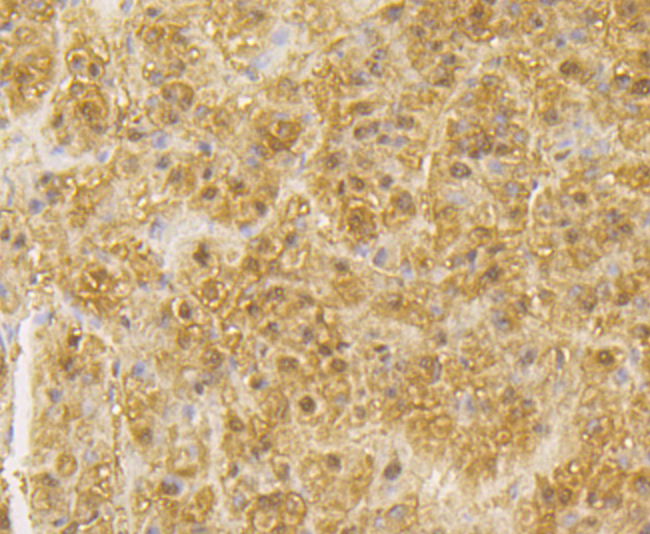 Immunohistochemical analysis of paraffin-embedded human liver tissue using anti-GLUR antibody. Counter stained with hematoxylin.