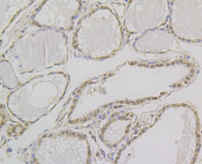 Immunohistochemical analysis of paraffin-embedded human thyroid gland tissue using anti-GLUR antibody. Counter stained with hematoxylin.