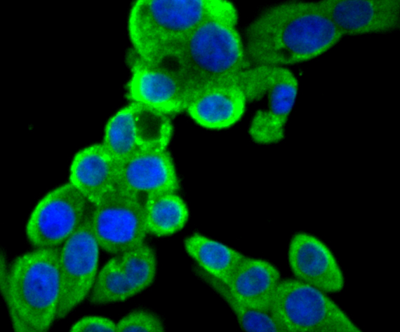 ICC staining Bcl2 in LOVO cells (green). The nuclear counter stain is DAPI (blue). Cells were fixed in paraformaldehyde, permeabilised with 0.25% Triton X100/PBS.