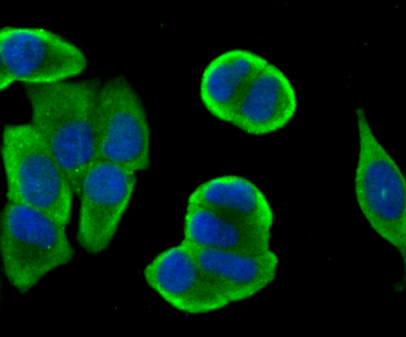 ICC staining Bcl2 in MCF-7 cells (green). The nuclear counter stain is DAPI (blue). Cells were fixed in paraformaldehyde, permeabilised with 0.25% Triton X100/PBS.