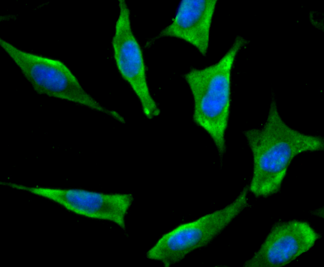 ICC staining Bcl2 in SH-SY-5Y cells (green). The nuclear counter stain is DAPI (blue). Cells were fixed in paraformaldehyde, permeabilised with 0.25% Triton X100/PBS.
