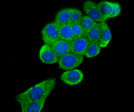 ICC staining ERGI3 in LOVO cells (green). The nuclear counter stain is DAPI (blue). Cells were fixed in paraformaldehyde, permeabilised with 0.25% Triton X100/PBS.