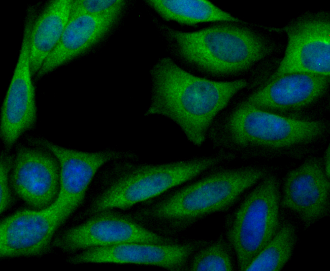 ICC staining ERGI3 in SiHa cells (green). The nuclear counter stain is DAPI (blue). Cells were fixed in paraformaldehyde, permeabilised with 0.25% Triton X100/PBS.