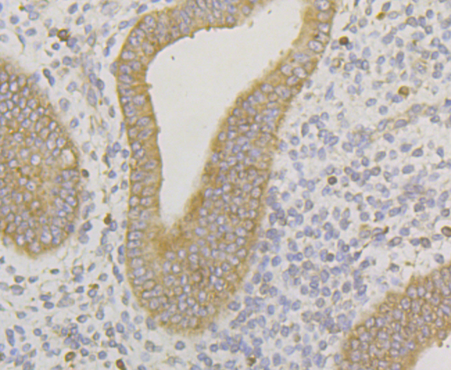 Immunohistochemical analysis of paraffin-embedded human uterus tissue using anti-ERGI3 antibody. Counter stained with hematoxylin.