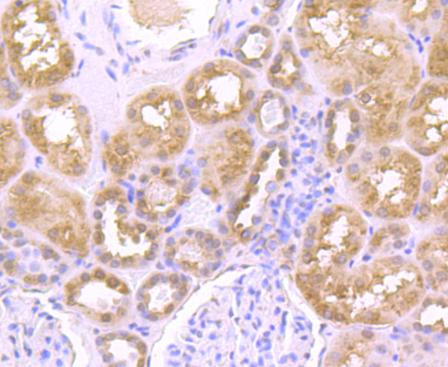 Immunohistochemical analysis of paraffin-embedded human kidney tissue using anti-LAMP2a antibody. Counter stained with hematoxylin.