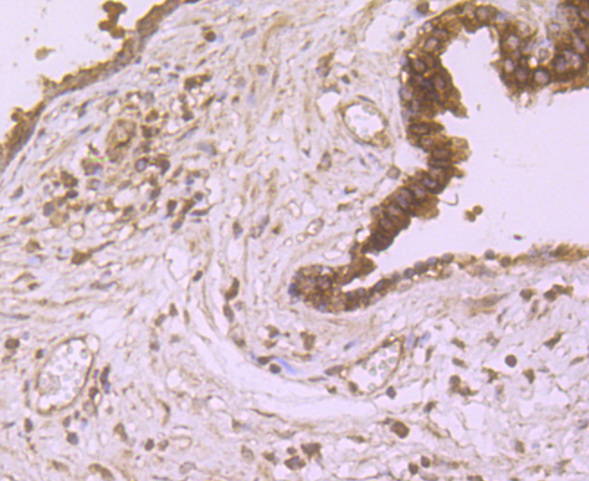 Immunohistochemical analysis of paraffin-embedded human prostate tissue using anti-LAMP2a antibody. Counter stained with hematoxylin.