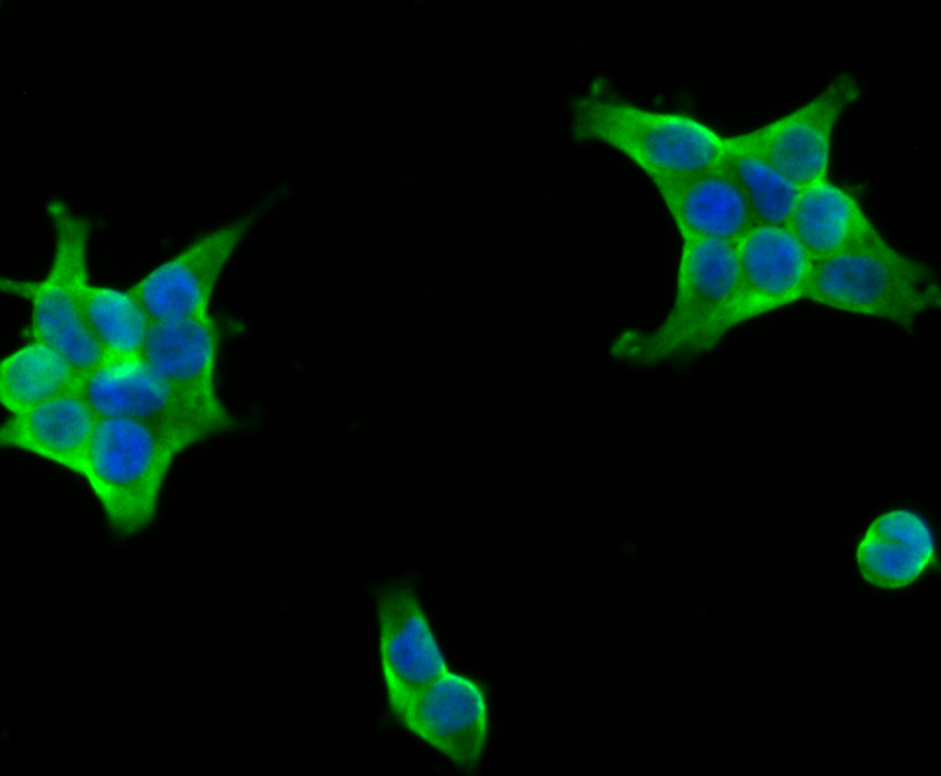 ICC staining UAP1 in 293T cells (green). The nuclear counter stain is DAPI (blue). Cells were fixed in paraformaldehyde, permeabilised with 0.25% Triton X100/PBS.