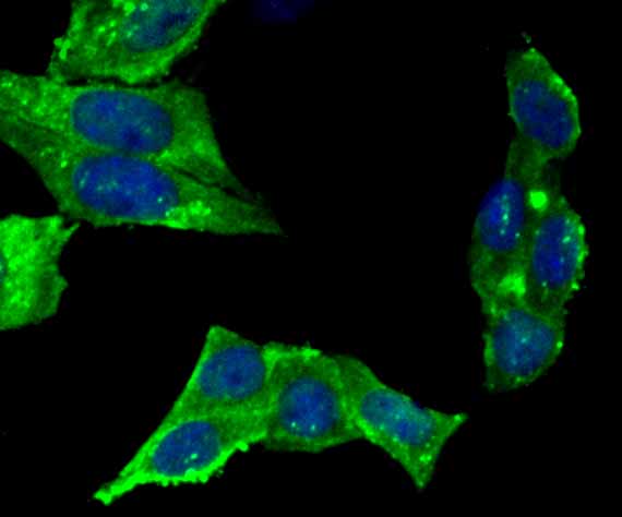 ICC staining UAP1 in SiHa cells (green). The nuclear counter stain is DAPI (blue). Cells were fixed in paraformaldehyde, permeabilised with 0.25% Triton X100/PBS.