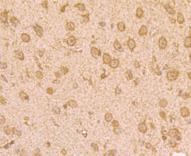 Immunohistochemical analysis of paraffin-embedded rat brain tissue using anti-UAP1 antibody. Counter stained with hematoxylin.