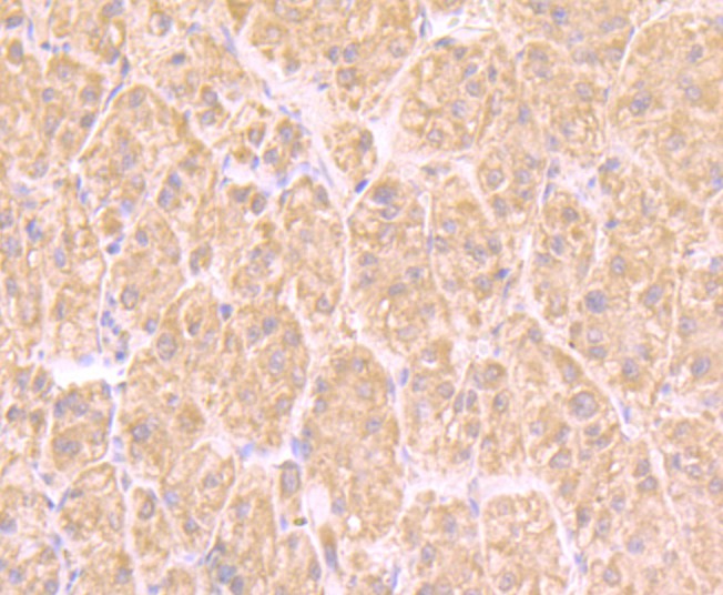 Immunohistochemical analysis of paraffin-embedded human liver tissue using anti-UAP1 antibody. Counter stained with hematoxylin.