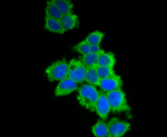 ICC staining UAP1 in 293T cells (green). The nuclear counter stain is DAPI (blue). Cells were fixed in paraformaldehyde, permeabilised with 0.25% Triton X100/PBS.