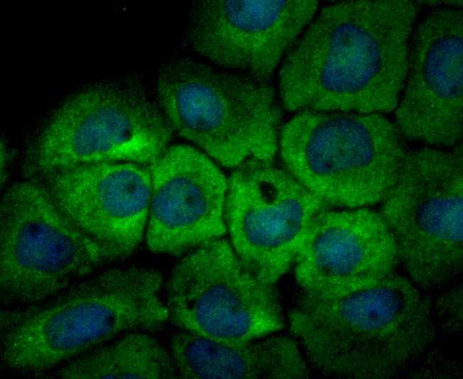 ICC staining UAP1 in A431 cells (green). The nuclear counter stain is DAPI (blue). Cells were fixed in paraformaldehyde, permeabilised with 0.25% Triton X100/PBS.