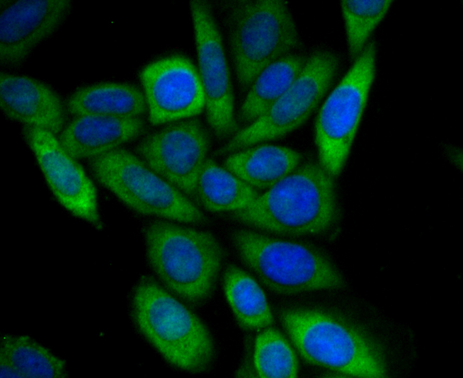 ICC staining UAP1 in SiHa cells (green). The nuclear counter stain is DAPI (blue). Cells were fixed in paraformaldehyde, permeabilised with 0.25% Triton X100/PBS.
