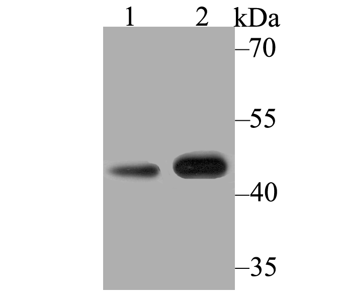 Western blot analysis of Kir3.4 on different lysates using anti-Kir3.4 antibody at 1/500 dilution.<br />
 Positive control:<br />
 Lane 1: Mouse heart <br />
   Lane 2: Rat heart