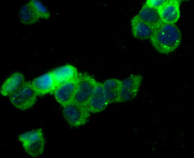 ICC staining Kir3.4 in 293T cells (green). The nuclear counter stain is DAPI (blue). Cells were fixed in paraformaldehyde, permeabilised with 0.25% Triton X100/PBS.