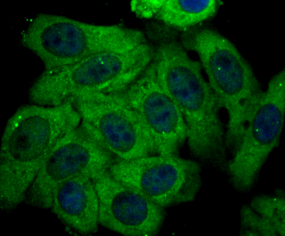 ICC staining Kir3.4 in HepG2 cells (green). The nuclear counter stain is DAPI (blue). Cells were fixed in paraformaldehyde, permeabilised with 0.25% Triton X100/PBS.