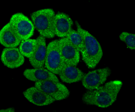 ICC staining Kir3.4 in LOVO cells (green). The nuclear counter stain is DAPI (blue). Cells were fixed in paraformaldehyde, permeabilised with 0.25% Triton X100/PBS.