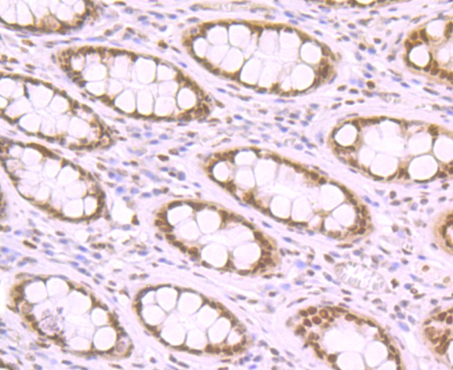 Immunohistochemical analysis of paraffin-embedded human colon tissue using anti-macroH2A.1 antibody. Counter stained with hematoxylin.