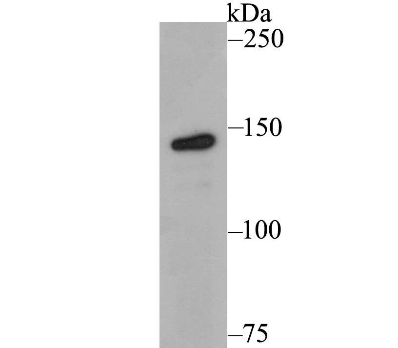 Western blot analysis of Tyk2 on MCF-7 cell lysates. Proteins were transferred to a PVDF membrane and blocked with 5% BSA in PBS for 1 hour at room temperature. The primary antibody (ER1803-05, 1/500) was used in 5% BSA at room temperature for 2 hours. Goat Anti-Rabbit IgG - HRP Secondary Antibody (HA1001) at 1:200,000 dilution was used for 1 hour at room temperature.