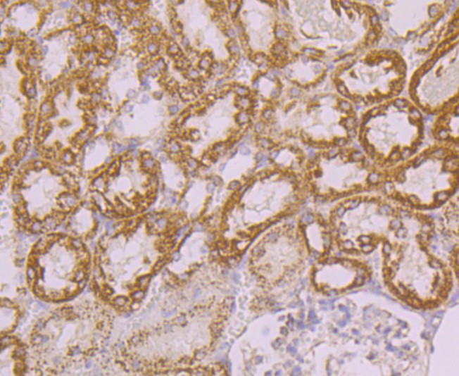 Immunohistochemical analysis of paraffin-embedded rat kidney tissue using anti-Tyk2 antibody. The section was pre-treated using heat mediated antigen retrieval with Tris-EDTA buffer (pH 9.0) for 20 minutes.The tissues were blocked in 1% BSA for 30 minutes at room temperature, washed with ddH2O and PBS, and then probed with the primary antibody (ER1803-05, 1/50) for 30 minutes at room temperature. The detection was performed using an HRP conjugated compact polymer system. DAB was used as the chromogen. Tissues were counterstained with hematoxylin and mounted with DPX.