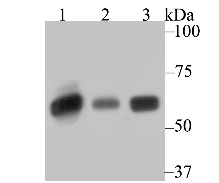 Western blot analysis of SERPINC1 on different lysates using anti-SERPINC1 antibody at 1/500 dilution.<br />
 Positive control:<br />
 Lane 1: HepG2   <br />
    Lane 2: Mouse smooth muscle<br />
 Lane 3: Mouse lung