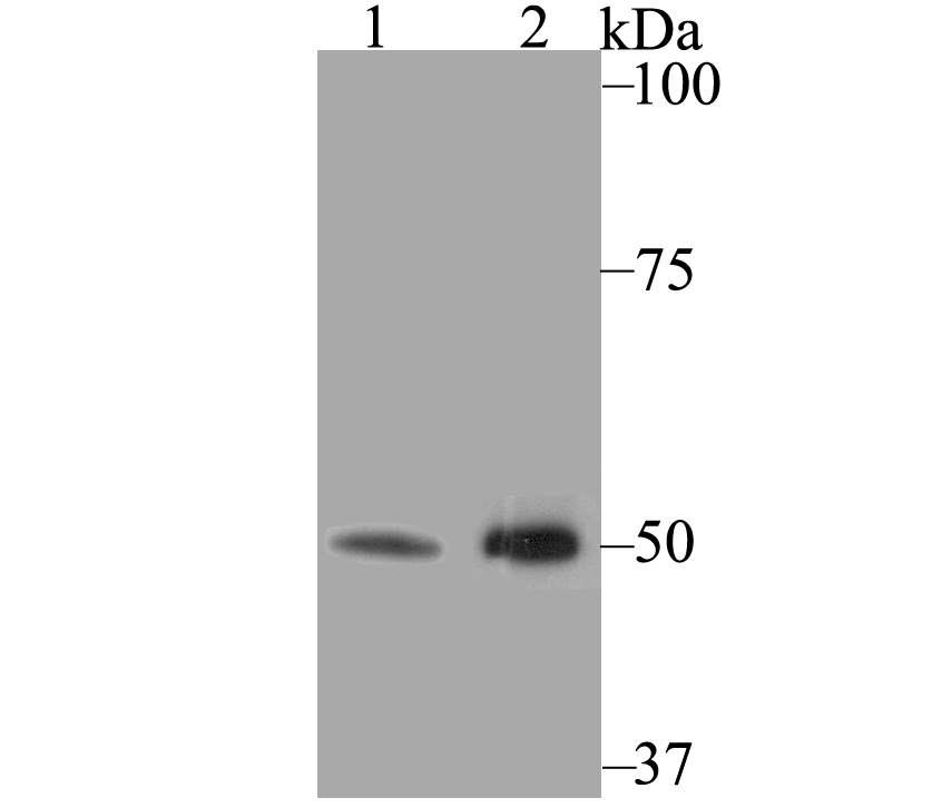 Western blot analysis of K2P4.1 on different lysates using anti-K2P4.1 antibody at 1/500 dilution.<br />
 Positive control:<br />
 Lane 1: Mouse colon  <br />
 Lane 2: Rat kidney