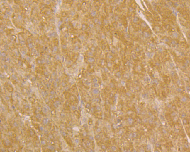 Immunohistochemical analysis of paraffin-embedded human liver tissue using anti-UQCRC2 antibody. Counter stained with hematoxylin.