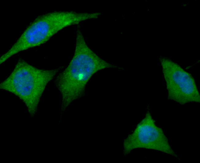 ICC staining ApoER2 in SH-SY-5Y cells (green). The nuclear counter stain is DAPI (blue). Cells were fixed in paraformaldehyde, permeabilised with 0.25% Triton X100/PBS.