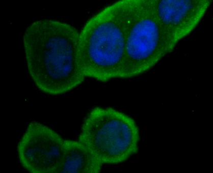 ICC staining Orai1 in MCF-7 cells (green). The nuclear counter stain is DAPI (blue). Cells were fixed in paraformaldehyde, permeabilised with 0.25% Triton X100/PBS.