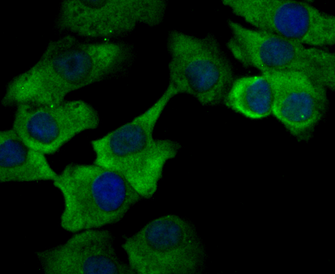 ICC staining Orai3 in A549 cells (green). The nuclear counter stain is DAPI (blue). Cells were fixed in paraformaldehyde, permeabilised with 0.25% Triton X100/PBS.