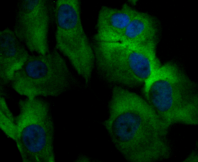 ICC staining Orai3 in MG-63 cells (green). The nuclear counter stain is DAPI (blue). Cells were fixed in paraformaldehyde, permeabilised with 0.25% Triton X100/PBS.