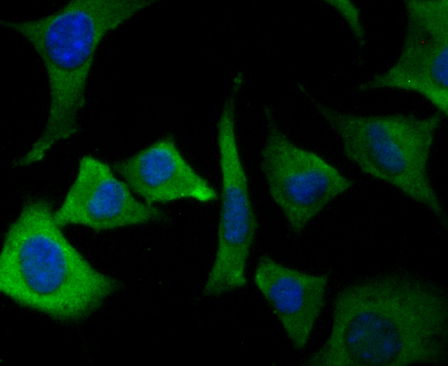 ICC staining Orai3 in SH-SY-5Y cells (green). The nuclear counter stain is DAPI (blue). Cells were fixed in paraformaldehyde, permeabilised with 0.25% Triton X100/PBS.