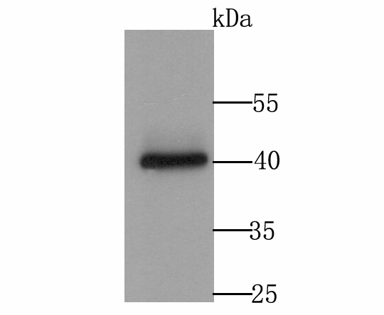 Western blot analysis of Cacng4 on MCF-7 cell lysate using anti-Cacng4 antibody at 1/500 dilution.