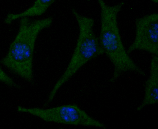 ICC staining Cacng4 in SH-SY-5Y cells (green). The nuclear counter stain is DAPI (blue). Cells were fixed in paraformaldehyde, permeabilised with 0.25% Triton X100/PBS.