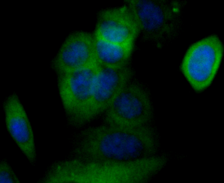 ICC staining Cacng4 in MCF-7 cells (green). The nuclear counter stain is DAPI (blue). Cells were fixed in paraformaldehyde, permeabilised with 0.25% Triton X100/PBS.
