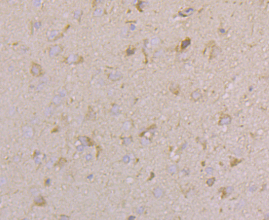 Immunohistochemical analysis of paraffin-embedded rat brain tissue using anti- Cacng4 antibody. Counter stained with hematoxylin.